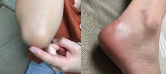 จุดแห้งกร้าน