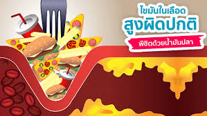 ไขมันอุดตัน
