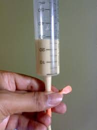 ให้อาหารทางสาย