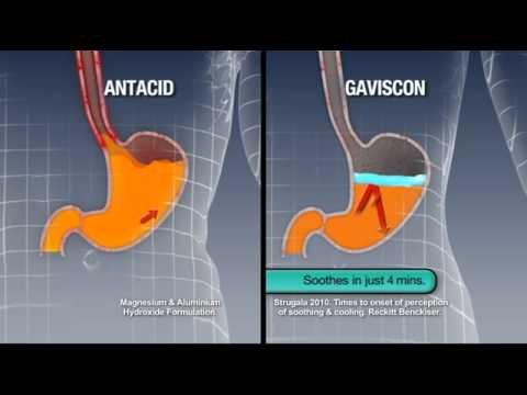 กาวิสคอน