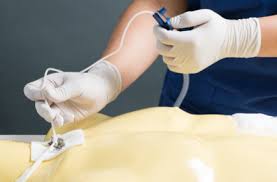 ดูดเสมหะทางคอ